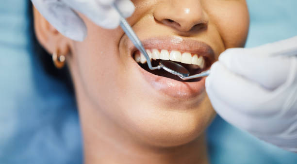Best Mobile Emergency Dentist in Stallion Springs, CA